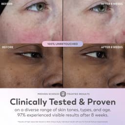 Olay Super Serum 5 in 1 Skin Enhancing Face Serum - Thumbnail 5